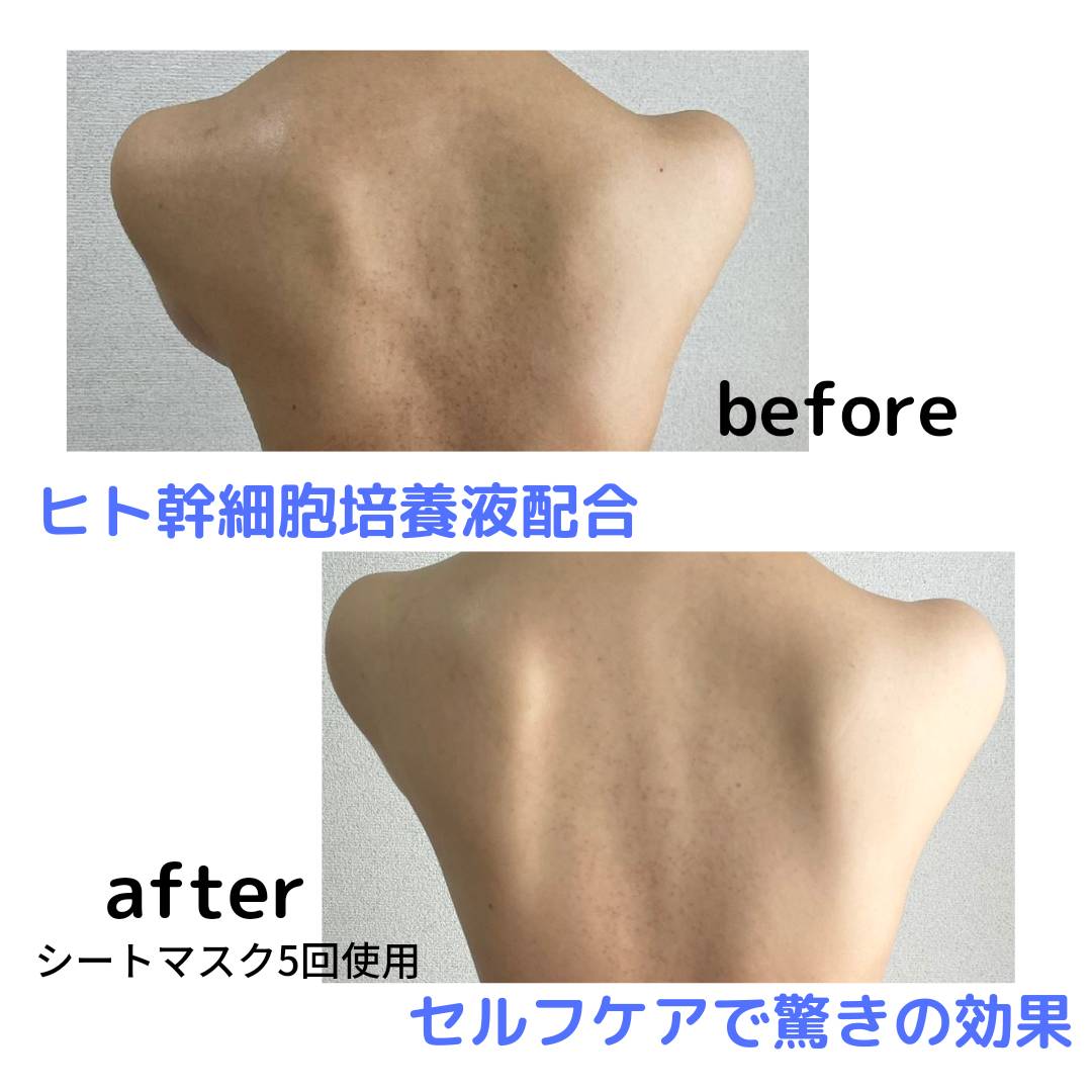 LMOSA背中デコルテシートマスク3枚セット【結婚式 ギフト 美容グッズ】